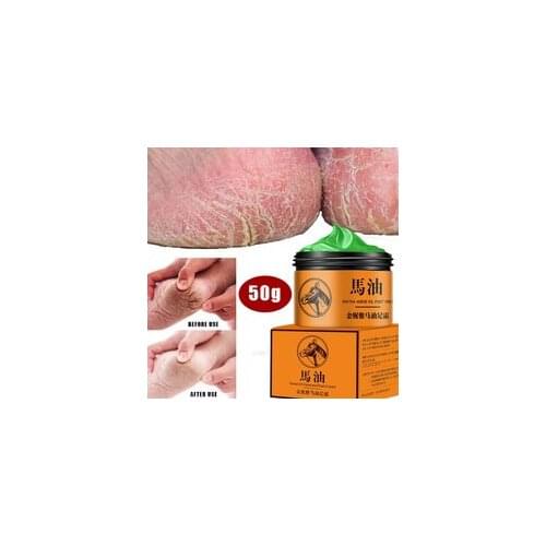 Horse Oil Feet Cream Care Cream for Foot Feet It ch Blisters Anti-chapping Peeling Beriberi Bad Feet Ointment