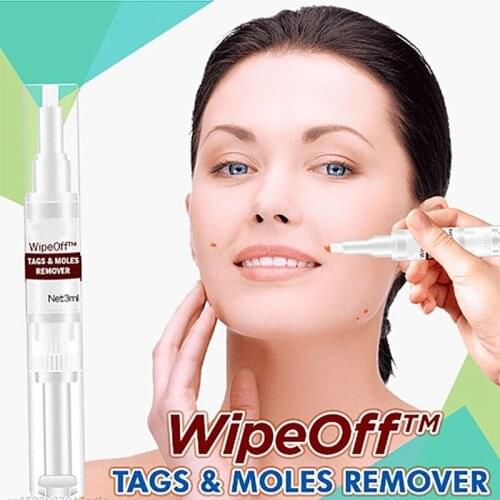 High Quality Wipe Off Tags Moles Remover 3ml Skin Tags Mole Remover Effective Formula for Skin Tags Removal