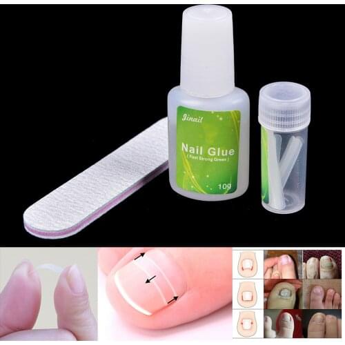 12PCS Toenail Ingrown Straightening Clip Curved Brace With Glue Kit for Toenails Toe nail Toenail Pedicure Tool