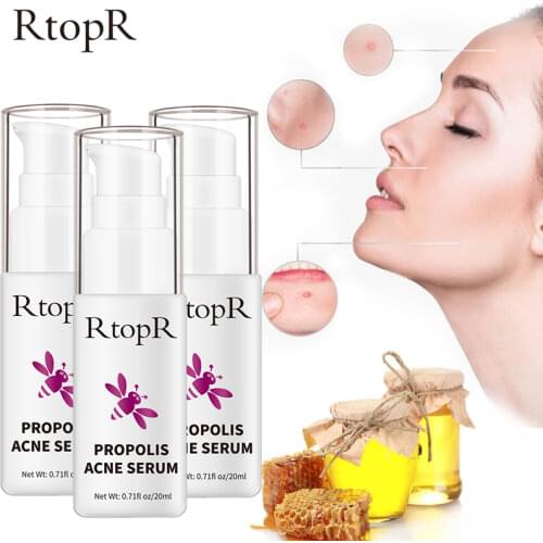 RtopR Acne Brightening Essence Acne Scar Repair Moisturizing Serum Shrinkage Elimination Acne Treatment Propolis Oil Control 3ps