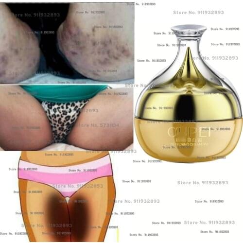 Inner Thigh Lightening Cream, Strong Dark Spots Eraser, Spotless Skin