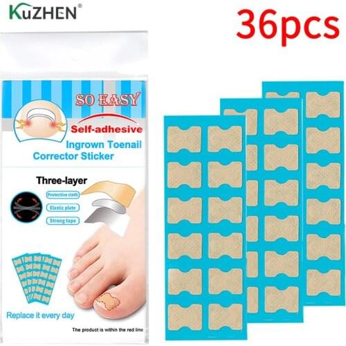 36pcs/pack Ingrown Toenail Correction Stickers Pedicure Tool Professional Embedded Toe Nail Corrector Foot Care Toenail Patch