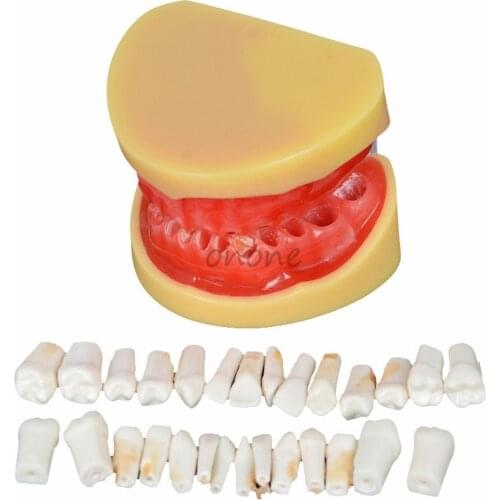 Dental All Teeth Removable Standard Teeth Tooth Model 28 pcs Teeth Student Learning Model