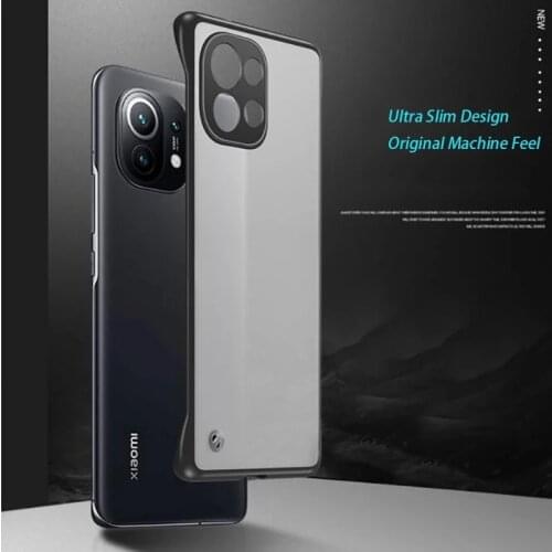 CHUYONG Xiaomi Mi 11 Phone Cases