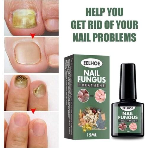 Gorrupe Nail Oils