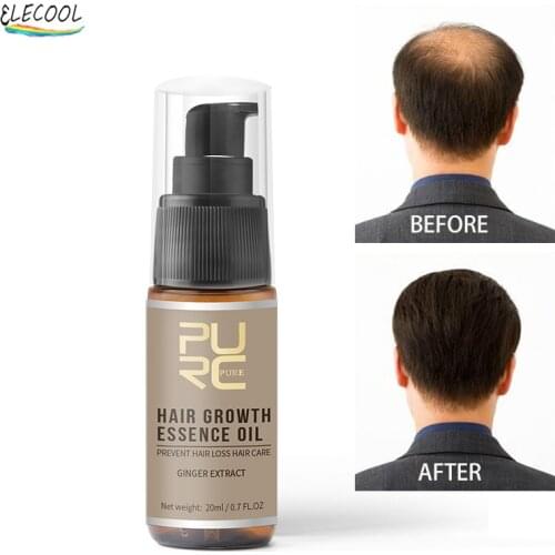 ELECOOL Hair Growth Products Fast Growing Hair Oil Repair Hair Loss Care Spray Beauty Hair & Scalp Treatment For Men Women 20ml