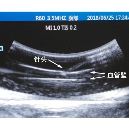 Ultrasound guided vascular puncture model PICC training puncture module circulation pump B-ultrasound intervention training