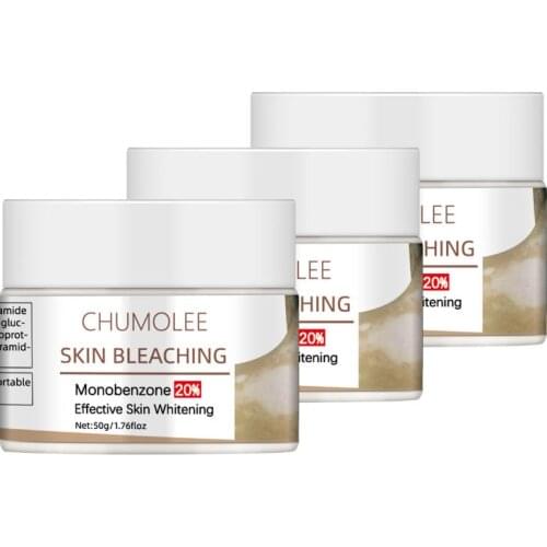 3pcs Chumolee Monobenzone Face Whitening Cream Skin Bleaching Fades Vitilig Dark Spots Age Spot Brightening Face Cream