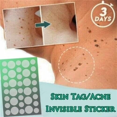 Skin Tag Patch Ance Pimple Patch Plaster Acne Cream Hydrocolloid Master Anti-infection Quick Absorb Face Care