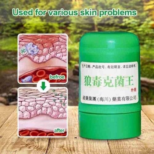 Antibacterial Cream For All Kinds Of Skin Problems Chinese Psoriasis Medicine Ointment Eczma Plaster Massage Herbal Body Ca F9E3
