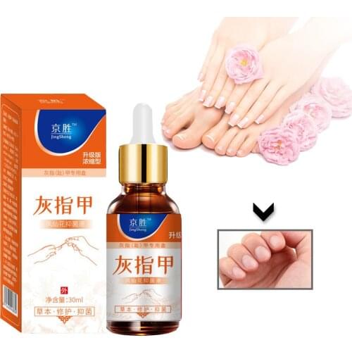 Onychomycosis Nail Repair Promote Regrow Nail Care Nail Essence Anti Infection Paronychia Leuconychia Toe Nails Removal Gel