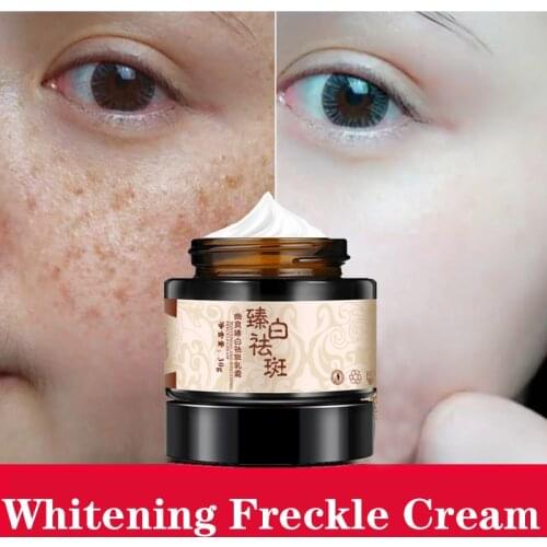 30ml Powerful whitening freckle cream Chinese herbal plant face cream remove freckles and dark spots 30g Skin whitening cream