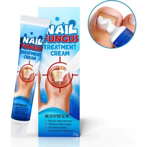 20g Nail Fungus Cream Toenail Fungus Remover Treatment Onychomycosis Paronychia Anti Infection Feet Toe Nail Care Gel NEW #E