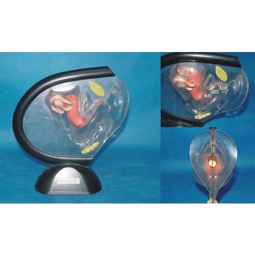 Human Transparent Uterus Ovaries Fallopian TubesAnatomy Medical Teaching Model