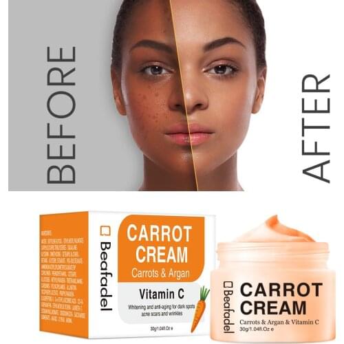 Carrot Face Cream Whitening Cream Dark Spot Corrector Blemish Brighten Anti-Acne Vitamin C 20% Freckle Remover Korean Skin Care