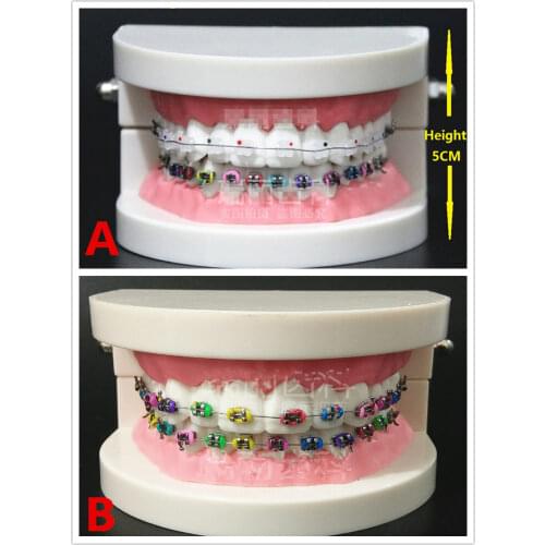 1PC Dental Orthodontic Treatment Model With Ortho Metal Bracket Arch Wire Buccal Tube Ligature Ties