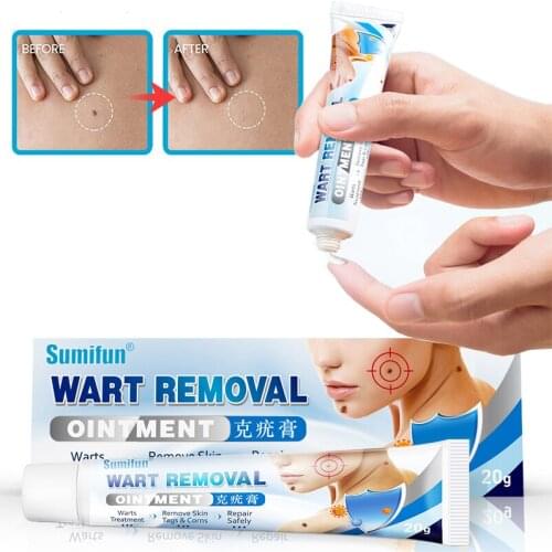 20g Wart Treatment Cream Herbal Wart Antibacterial Ointment Skin Tags Remover Face Foot Extract Corn Viral Medical Plaster Oil