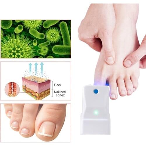 Nail Fungus Discoloration treatment 905nm cold laser and blue LED light therapy device for toe and finger Nail Fungus Remover