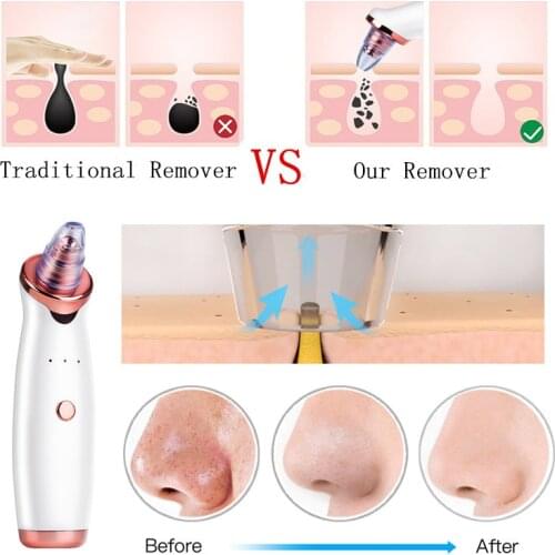 Facial Blackhead Remover Electric Acne Cleaner Blackhead Black Point Vacuum Cleaner Tool Black Spots Pore Cleaner Machine