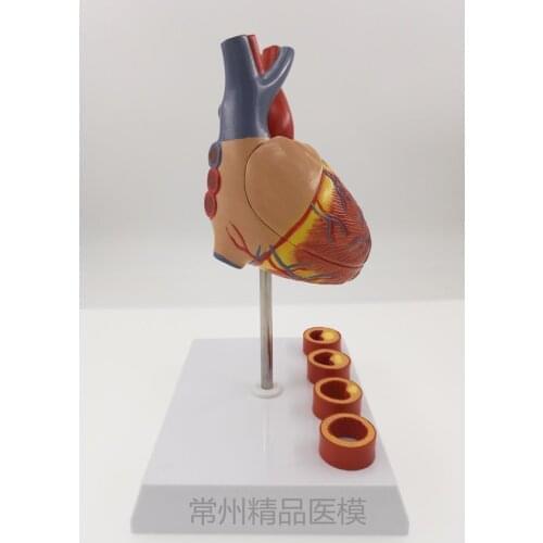 EducationTeaching model heart zone 4 stage vascular heart anatomy model heart blood vessel specimen heart structure