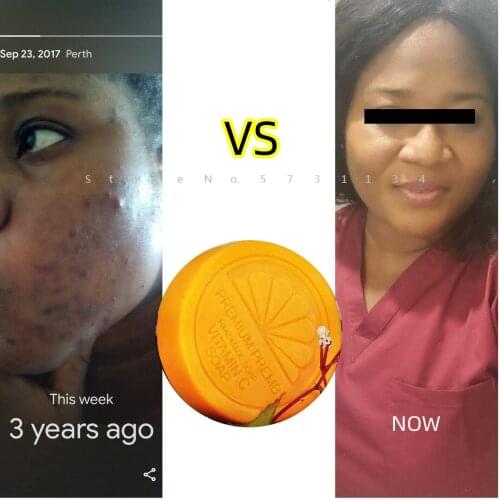 Vitamin C Soap Lightening Brightening Beauty Skin Soap Natural Extracts