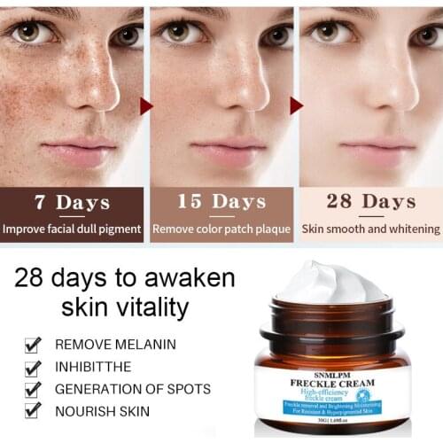 Powerful Whitening Freckle Cream Face Cream Dark Spots Removal Gel Skin Whitening Cream Brighten Moisturizing Skin Care TSLM1
