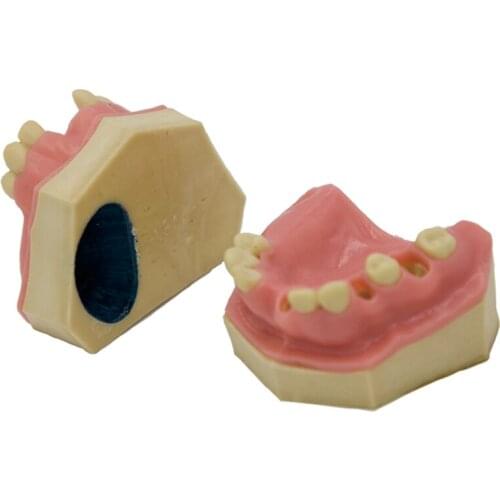 Dental implant practice Oral model Missing Band Sinus tooth Model