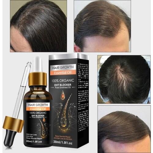 New Ginger Hair Growth Essence Germinal Repairing Split Ends, Improving Hair Care Essence Oil Hair Loss Treatment For Men Women