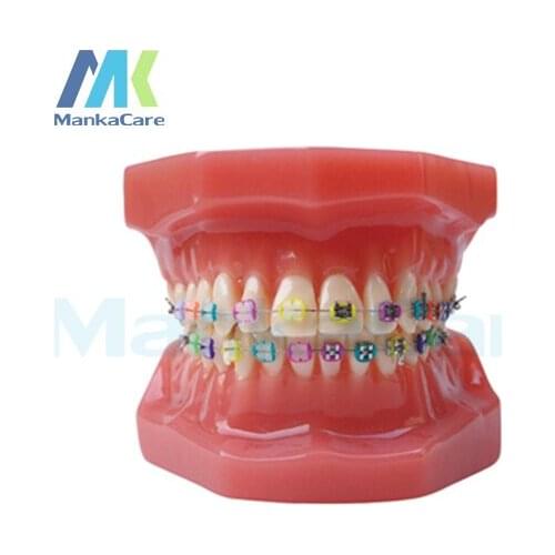 Manka Care - 28 pcs Tooth, half metal&half ceramic bracket Oral Model Teeth Tooth Model