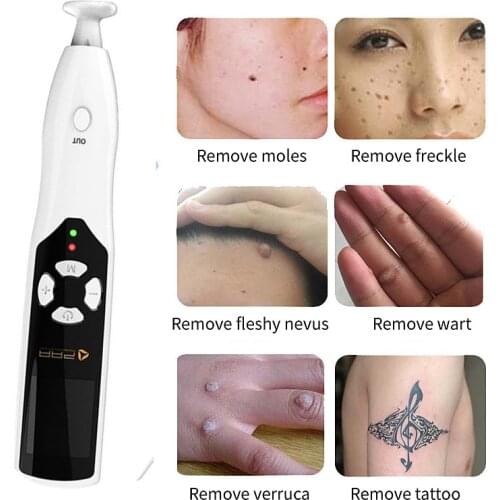 PAA 2 in 1 Ozone Eyelid Lifting Fibroblast Plasma Pen Acne Treatment Micro Plasma Pen For Wrinkle Freckle Spot Mole Removal