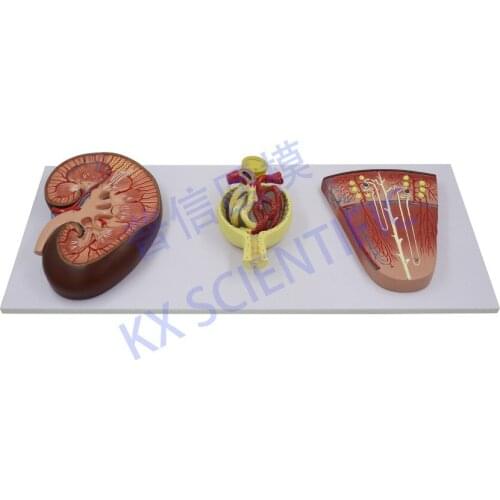 Free shipping&Kidney unit,glomerular enlargement model, the anatomy of the urinary system, medical teaching gifts, science