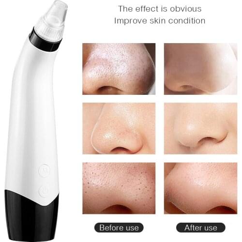 ShunRui Facial Care Tools