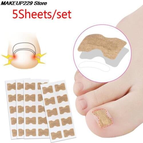 50Pc Fixer Paronychia Recover Toenail Elastic Patch Corrector Nail Art Ingrown Correction Sticker Foot Care Pedicure Tool 5sheet