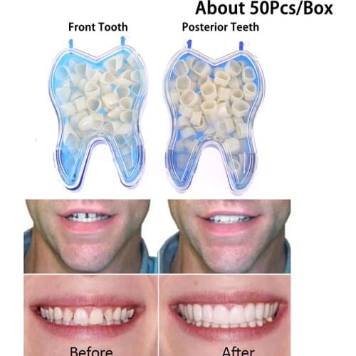 50Pcs/Box Dental Temporary Crown Kit Material Front Anterior Tooth Veneer Posterior Oral Care Posterior Molar Crown