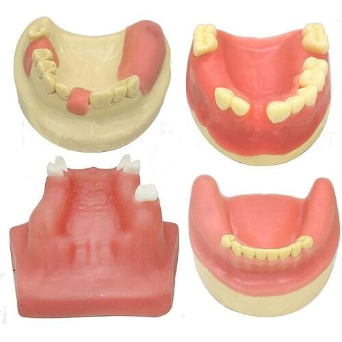 1Pcs Dental implant dental model oral material practice maxillary sinus dental supplies instruments tools soft gum