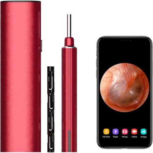 Miredor Ear Wax Removal With Camera,WIFI Visual Ear Cleaner,Visible Earpick Compatible With iPhone,iPad,Android Smart Phones