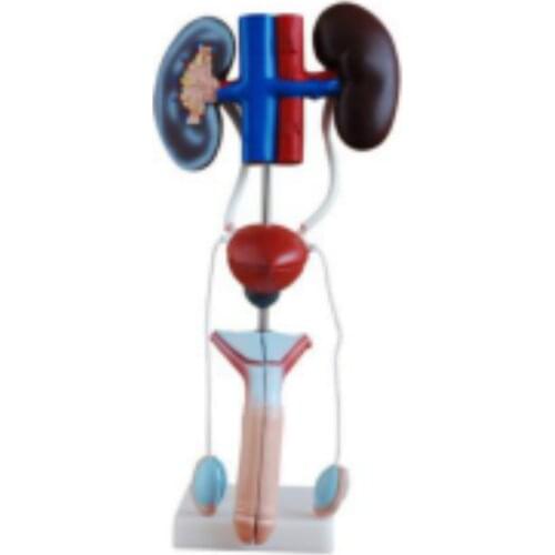 Model Of The Urinary System(Male) BIX-A1063 WBW418