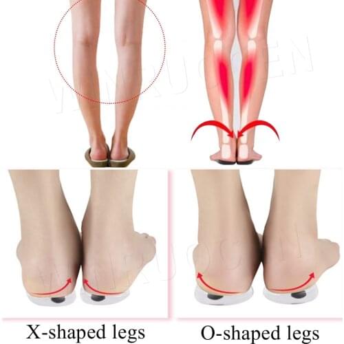 Magnetic Massage Insoles Gel Orthotics O/X Type Leg Orthotics Heel Pads Corrective Valgus Varus Foot Magnet Insoles Insert Pads