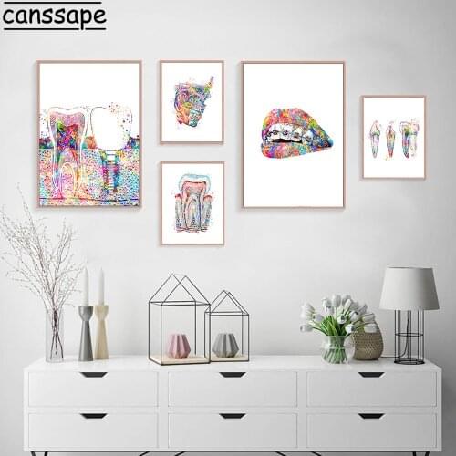 Tooth Implant Canvas Wall Painting Dental Art Poster Dentist Anatomy Prints Medical Wall Art Pictures Hospital Clinic Decoration