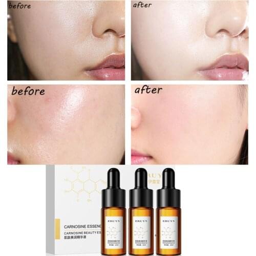 Face Serum Carnosine Solution Anti-glycation Essence Moisturizing Reduce dullness Repair Brighten Skin Collagen Skin Care Serum