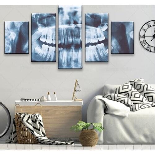 5 piece canvas x-ray Teeth dental picture Canvas picture painting room decor hd print poster wall art frame