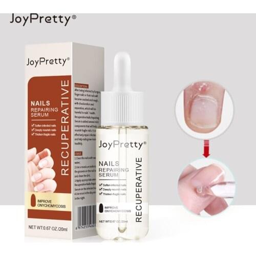 20 ML Nail Cuticle Oil Nourishing Anti-barb Soft Remover Dead Skin Repairing Onychomycosis Finger Edge Oil For Nails Manicure
