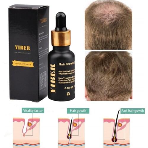 Hair Care Fast Hair Growth Products Regeneration Essence Liquid Care Prevention Hair Loss Treatment Dry Hairs Care Types Scalp