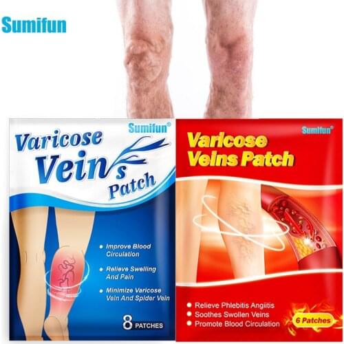 2 Type of Varicose Veins Patch Phlebitis Vasculitis Treatment Sticker Thigh Spider Removal Pain Relief Care Plaster