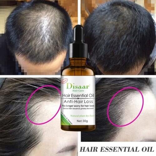 New Hair Growth Essence Oil Fast Powerful Hair Growth Oil Products Essential Oil Treatment Preventing Hair Loss Hair Care 30ml