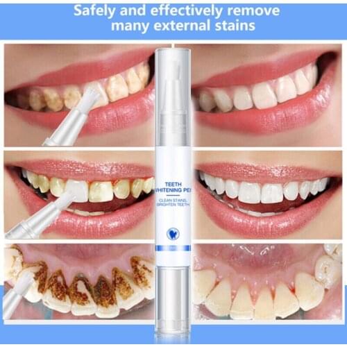 5ml Teeth Whitening Pen Cleaning Serum Plaque Stains Removal Dental Tools Oral Hygiene Brighten Tooth Bleaching Whitener 27RC