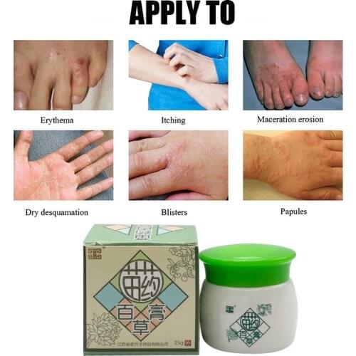 25g Chinese Medicine Psoriasis Cream Herbal Antibacterial Eczema Ointment Antipruritic Relief Treatment Skin Rash Skin Care