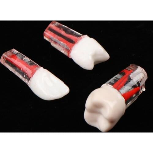 1 Pc Resin Dental Endodontic Tooth Model With Colored Root Canal And Pulp Practice