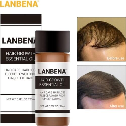 Fast Powerful Hair Growth Essence Products Essential Oil Liquid Treatment Preventing Hair Loss Hair Care Regrowth Serum 20ml