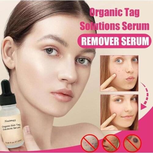 Organic Skin Spot Purifying Serum Natural Free Painless Mole Tag Removal Odorless Face Freckle Repair Cream Health Care